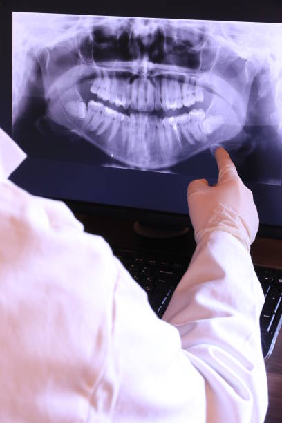 Best Emergency Root Canal Treatment in Boone, NC