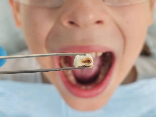 Best Pediatric Emergency Dentist in Boone, NC