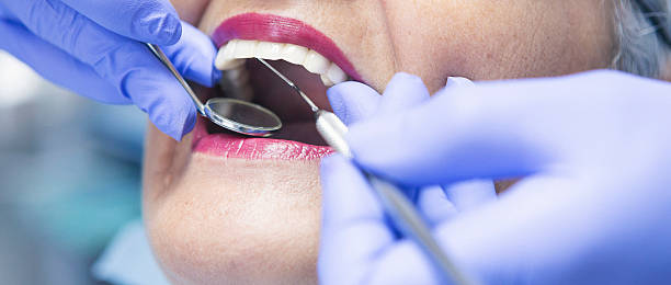 Best Emergency Denture Repair in Boone, NC
